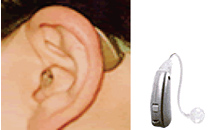 補聴器